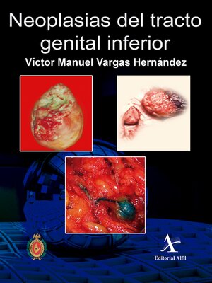 cover image of Neoplasias del tracto genital inferior